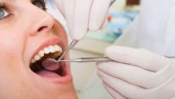 dentista a roma